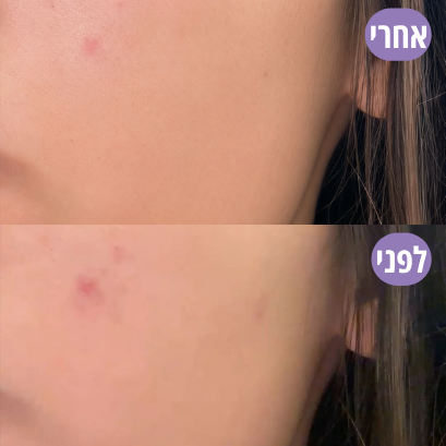 נועה